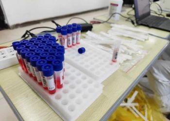 核酸检测筑防线 凝心聚力护安全——陕西北方工程技术学校第二次全员核酸检测纪实